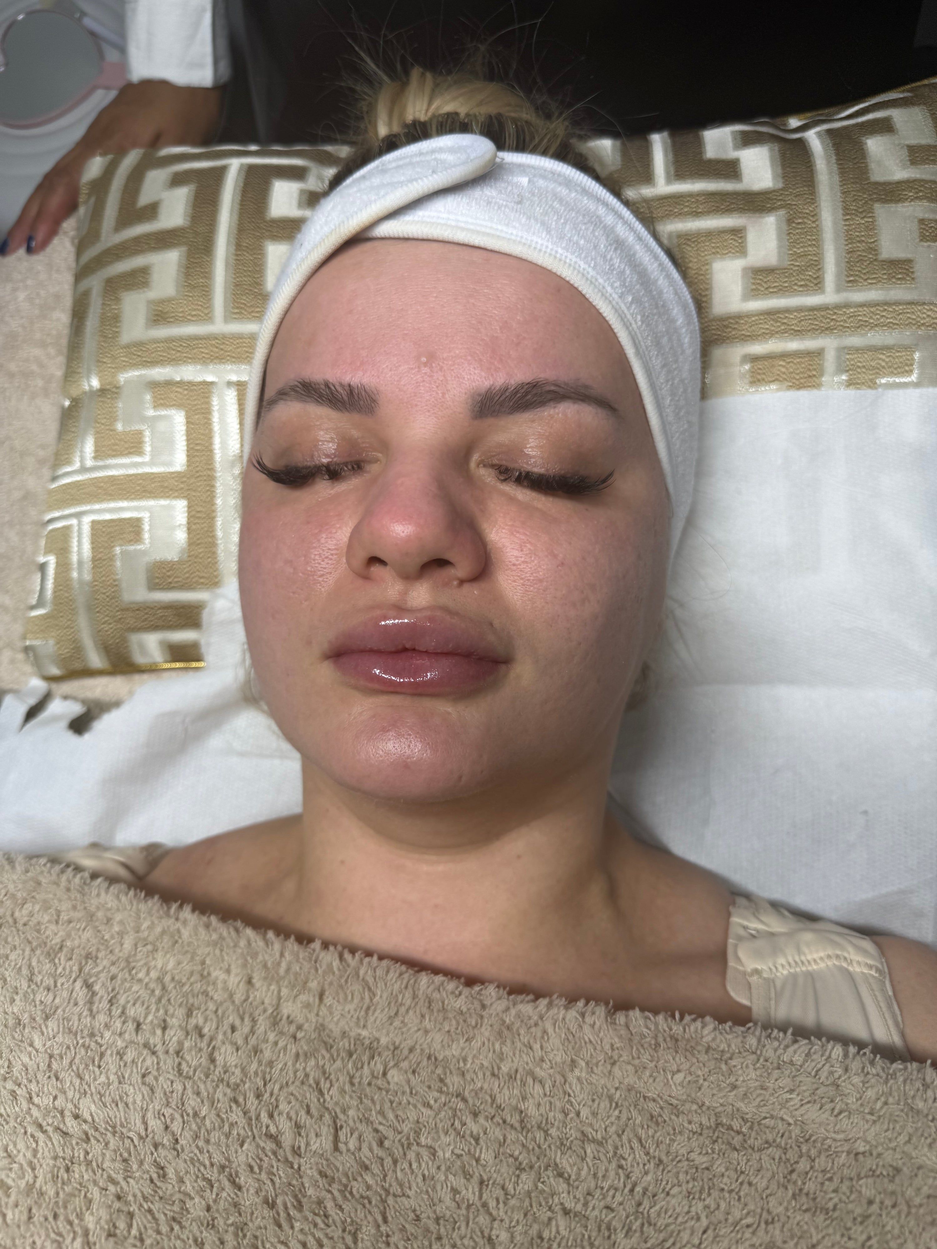 Charger la vidéo: Le soin hydrafacial c'est un soin complet qui nettoie en profondeur la peau. Elle combine le nettoyage, l'exfoliation et l'hydratation profonde de la peau. Il agit en aspirant les impuretés tout en infusant la peau d'actifs puissant. Nous infusons des actifs puissant tels que des antioxydants, des peptides et de l'acide hyaluronique qui hydrate, éclaircissent et protège la peau.